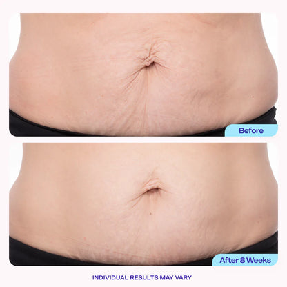 GOPURE - Tighten & Smooth Belly Cream