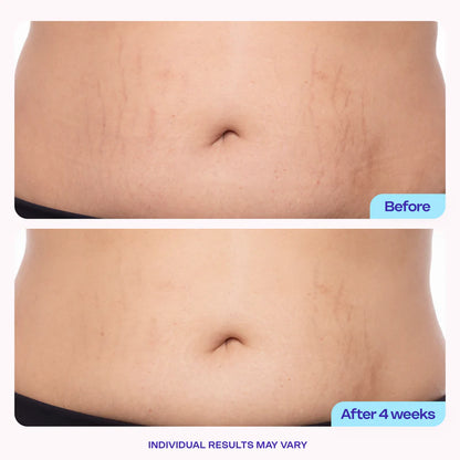 GOPURE - Tighten & Smooth Belly Cream